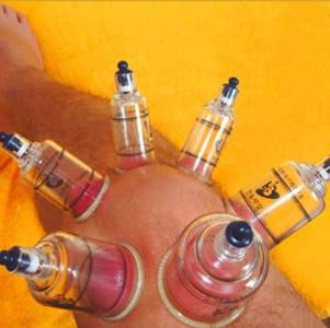 Bawar Cupping Clinic
