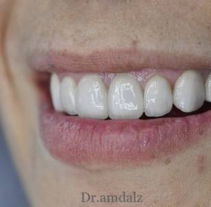 Dr. Abdulfatah Specialist In Oral And Maxillofacial Surgery