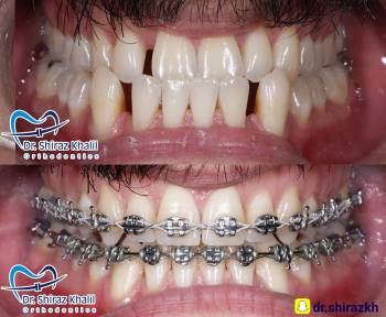 Drshiraz Dental Clinic